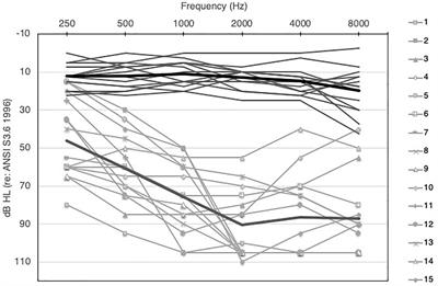 Musical Emotion Perception in Bimodal Patients: Relative Weighting of Musical Mode and Tempo Cues